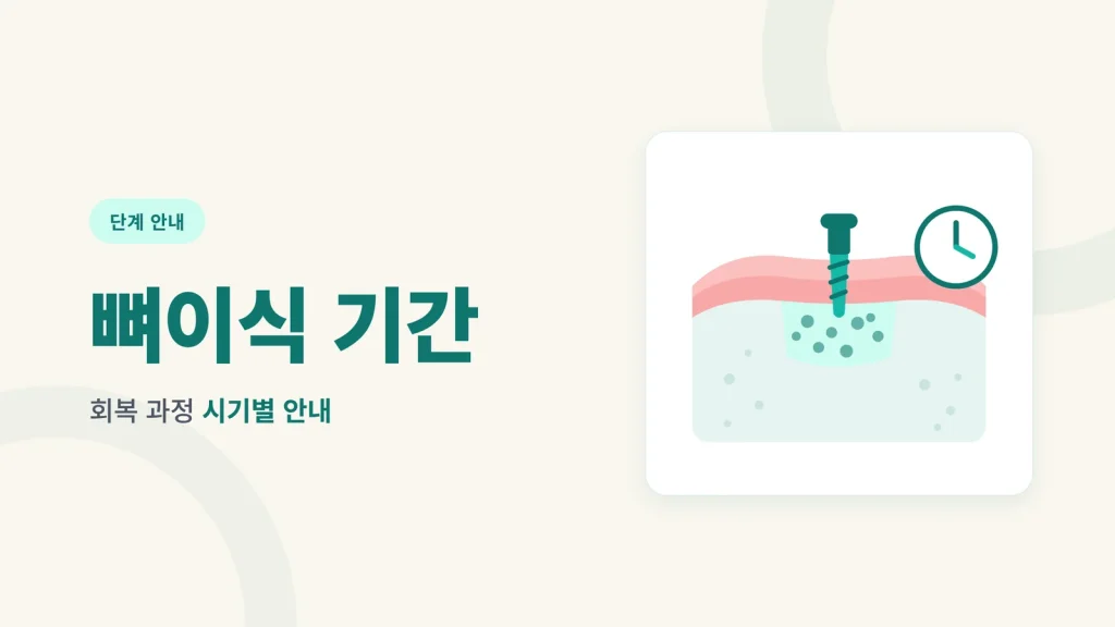 임플란트 뼈이식 기간과 회복 과정 시기별 안내 썸네일